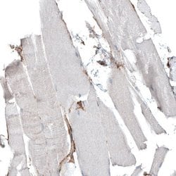 Integrin alpha 5/CD49e Antibody (CL6951), Novus Biologicals:Antibodies:Primary